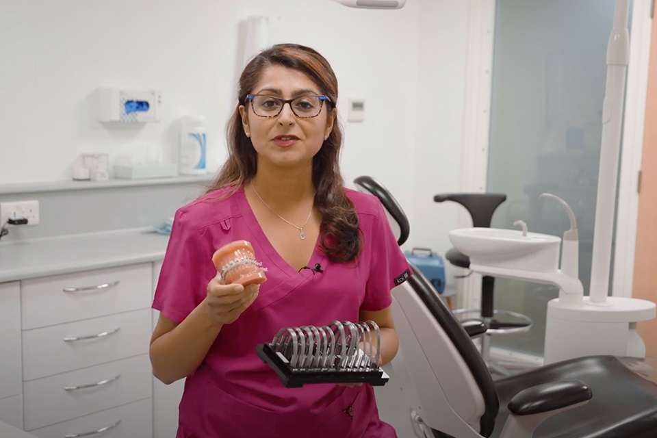 how-often-are-the-wires-changed