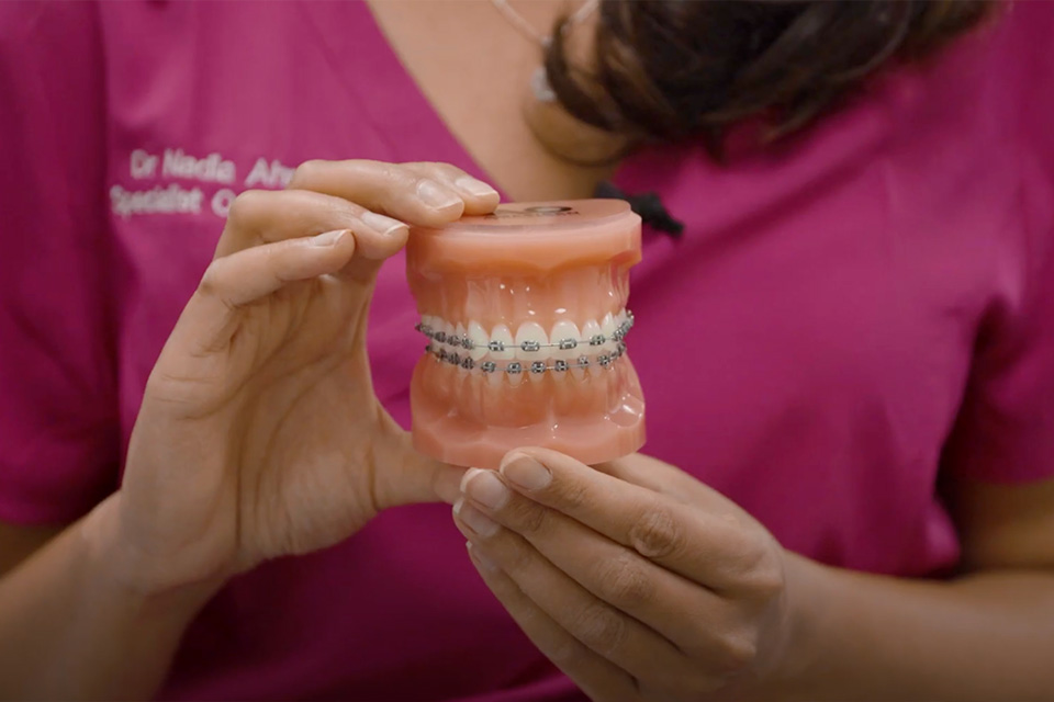 what-is-a-metal-fixed-brace